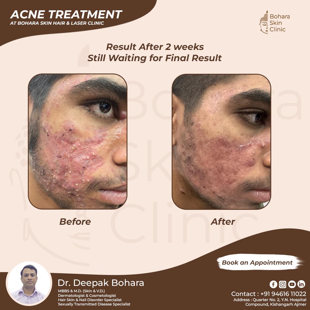 Before treatment